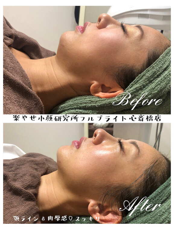ハイフォーカス