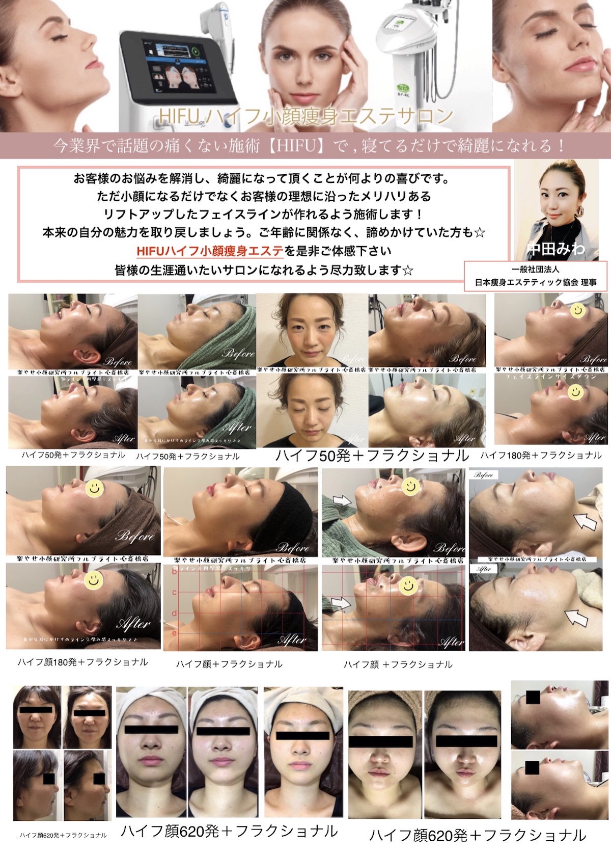 楽やせ小顔研究所フルブライト